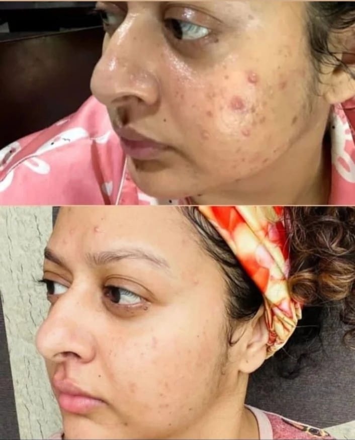 Makemebright Avocado Whitening Cream