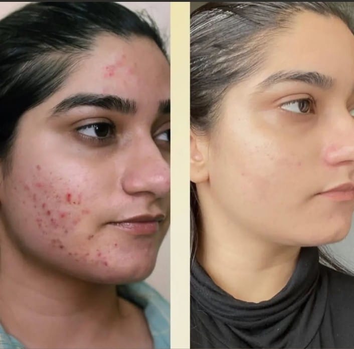 Makemebright Avocado Whitening Cream